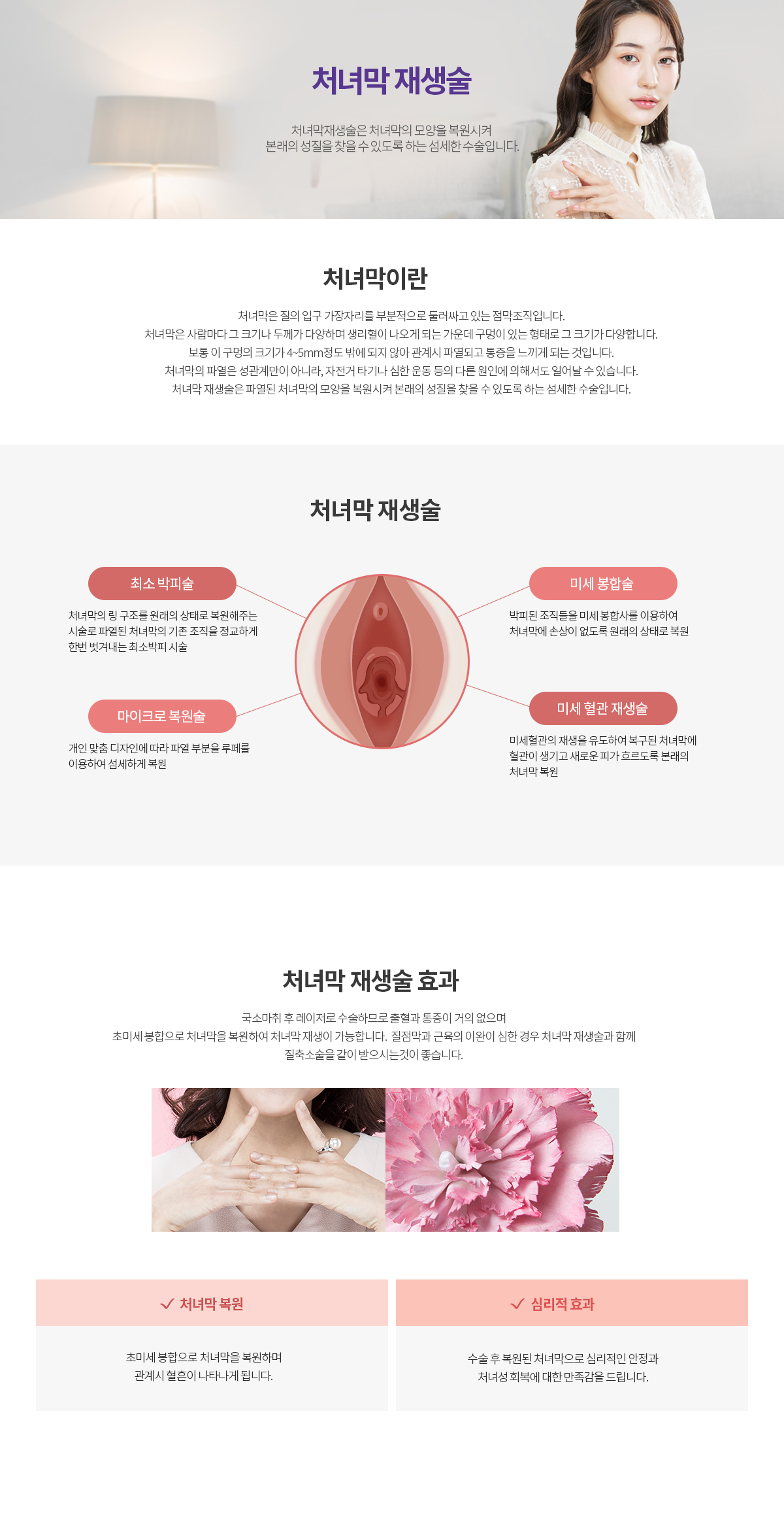 그녀가 진짜 인기있는 이유, 그녀가 진짜 즐거운 이유 처녀막재생술 처녀막은 아주 중요한 상징적 의미를 가지는 것으로 결혼 이후의 생활에도 중요한 영향을 미칩니다. 처녀막재생술은 처녀막의 모양을 복원시켜 본래의 성질을 찾을 수 잇도록 하는 섬세한 수술입니다. 수술방법 로앤의 처녀막재생술은 처녀막 모양만 복원시키는 기존 수술과 달리 모양과 함께 미세혈관의 재생을 유도하여 본래의 처녀막과 가장 유사한 형태로 복원시켜 드립니다. 국소마취 후 레이저로 수술하므로 출혈과 통증이 거의 없으며, 첫 관계시의 질 출혈만 위한 수술이 아닌 완전한 처녀막 모양 복원을 추구합니다. step1 최소 박피술 처녀막의 링 구조를 원래의 상태로 복원해주는 시술로 파열된 처녀막의 기존 조직을 정교하게 한번 벗겨내는 최소박피 시술, step2 마이크로 복원술 개인 맞춤 디자인에 따라 파열 부분을 루페를 이용하여 섬세하게 복원, step3 미세봉합술 박피된 조직들을 미세 봉합사를 이용하여 처녀막에 손상이 없도록 원래의 상태로 복원, step4 미세혈관 재생술 미세혈관의 재생을 유도하여 복구된 처녀막에 혈관이 생기고 새로운 피가 흐르도록 본래의 처녀막 복원 수술효과 처녀성 만족감 수술 후 처녀성 회복에 대한 만족감, 수술흔적 NO! 보이지 않는 실을 사용하여 정교하게 봉합, 첫 경험 출혈까지 복원 수술 후 회복경과를 거친 이후 성과계 시 혈흔이 보이게 됩니다, 안도감과 편안함 수술 후 복원된 처녀막으로 심리적인 안정감을 드립니다, 심리적 당당함 결혼 상대자인 남성에게 기쁨을 줍니다, 철저한 시크릿 진료 로앤은 환자의 비밀진료를 보장해드립니다. 처녀막재생술 파열된 처녀막으 ㄹ개인에 맞추어 정밀하게 복원시키며 미세 봉합실을 사용하여 수술 흔적을 찾아보기 어렵습니다.